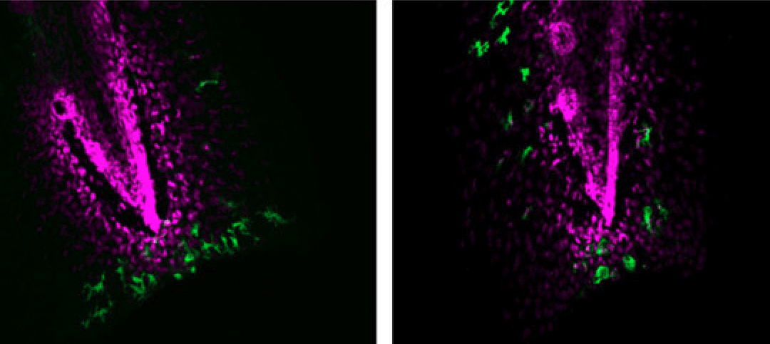 New Publication: “Leukotriene B4 Receptor 2 Governs Macrophage Migration During Tissue Inflammation”